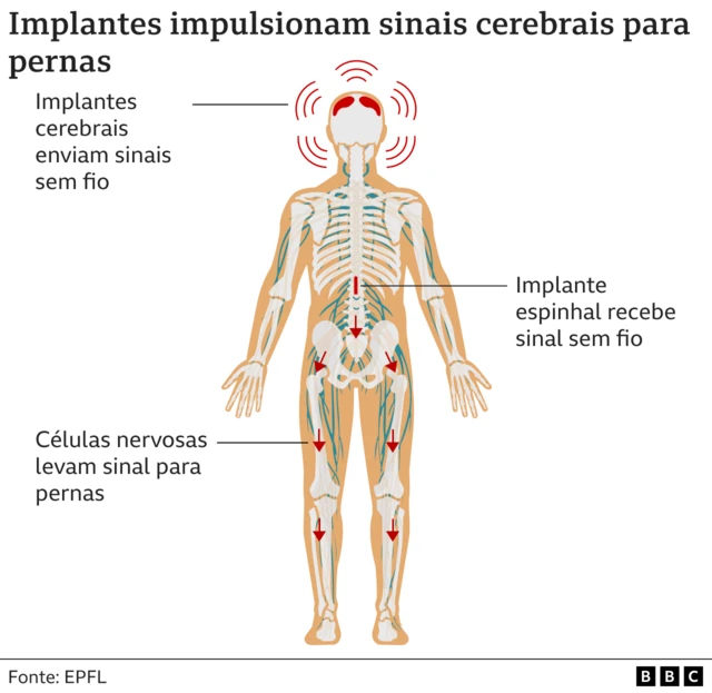 Gráfico