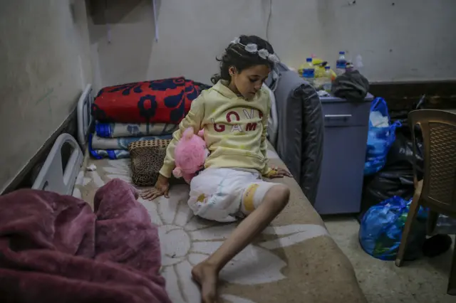 Photo d'archive de Hiba Muhanna, une enfant palestinienne qui a perdu sa jambe et son père lors d'un raid israélien dans le camp de Nuseirat, au centre de la bande de Gaza (décembre 2024).