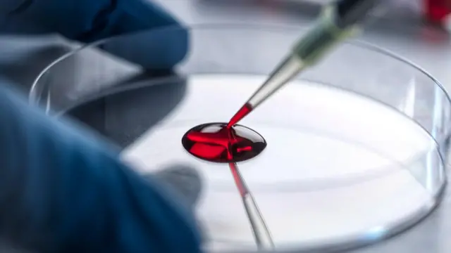 க்வாட நெகடிவ் என்ற அரிய ரத்த வகை கண்டுபிடிப்பு