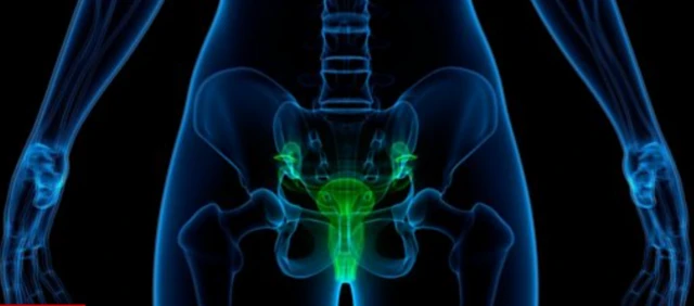 د رحم سرطان