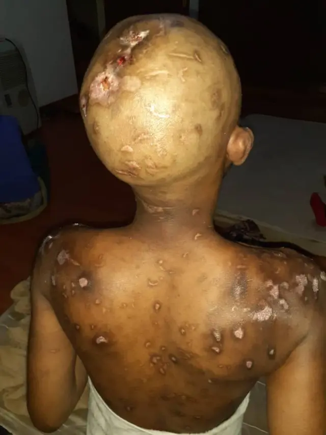 ሚርያም ኣብ ስዑዲ ዓረብ ብጓል ኣንስተይቲ ኣስራሒታ ብዝፈጸመቶ መውቃዕቲን ስቓየን ኣካላታ ከምዝተጎድአት ትገልጽ