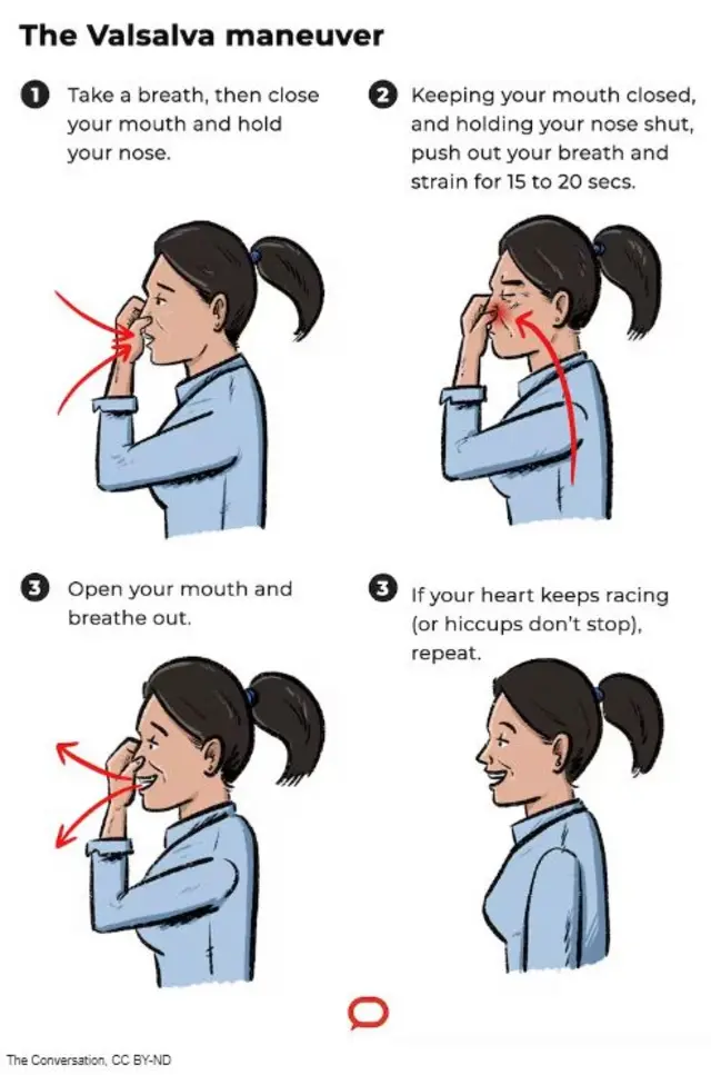 ہچکی اور علاج