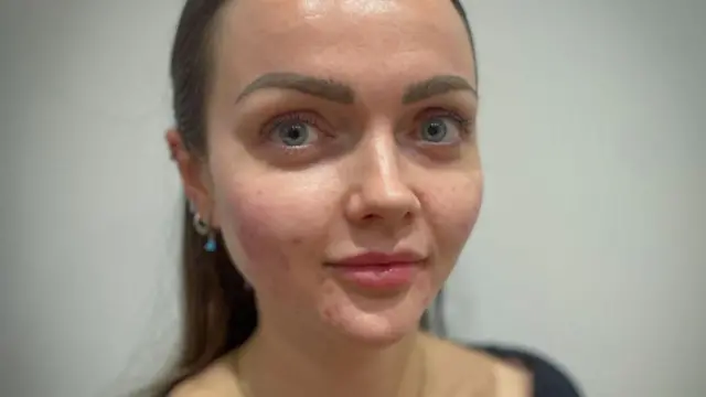 चार्ली एक्ससीएक्स म्हणतात की त्या पॉलीन्युक्लिओटाइड्सचा वापर करतात, जे 'काहीसं' त्वचेला इंजेक्शनद्वारे जीवनसत्व देण्यासारखं आहे