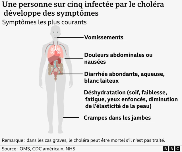 Le diagramme VisJo montre un corps humain avec les symptômes du choléra indiqués.