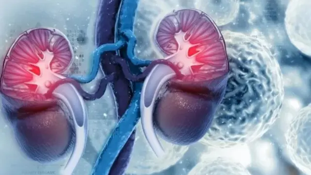 சிறுநீரகக்கல், அறுவை சிகிச்சை