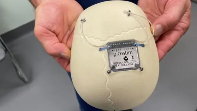 ओरनको खप्परभित्र राखिएको उपकरण