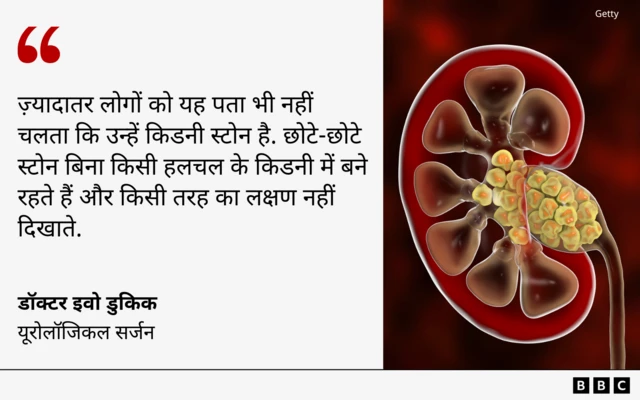 किडनी स्टोन पर डॉक्टर की सलाह