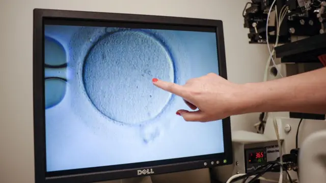 Seorang ahli Kesehatan menunjukkan sel telur setelah dibekukan di Pusat Kedokteran Reproduksi Virginia, AS.