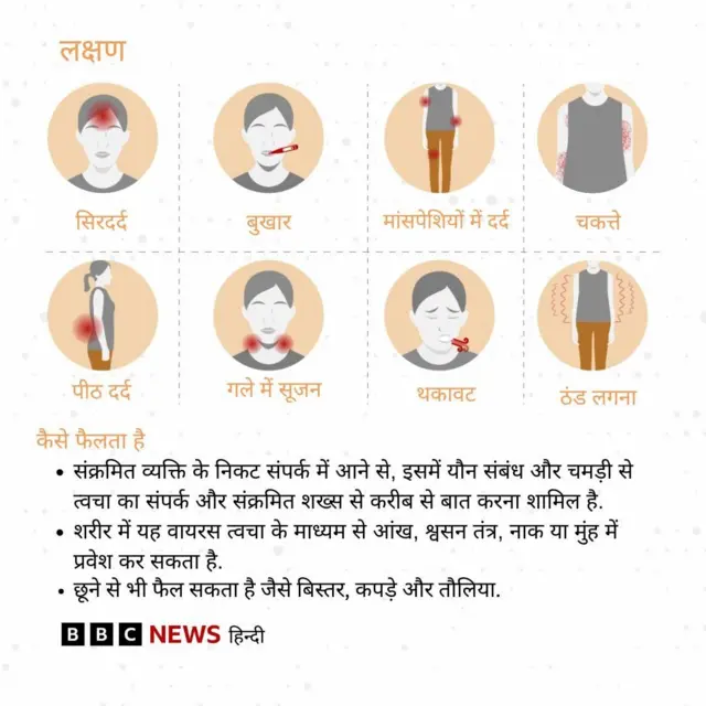 मंकी पॉक्स के लक्षण