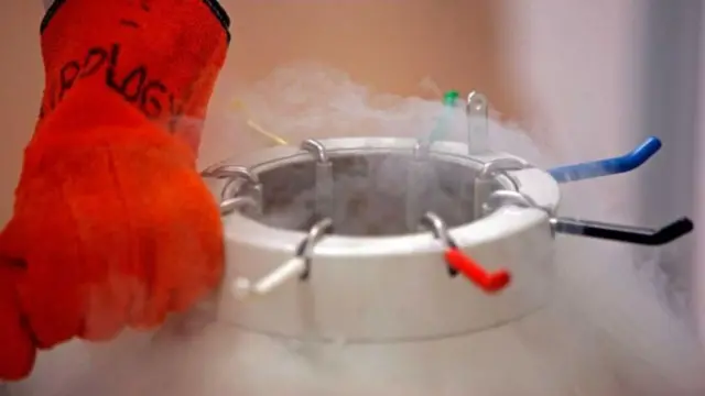 स्टेम सेल जतन 