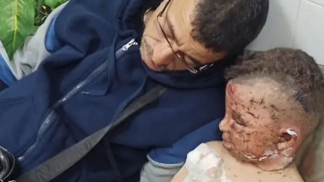 معين يأمل أن ينقل عمر إلى مصر لتلقي العلاج