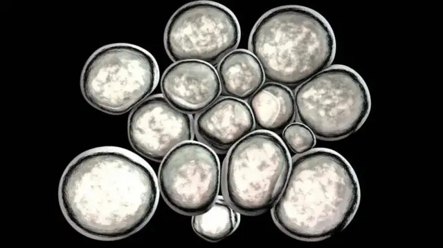 A computer illustration of white, round, and grey Ureaplasma urealyticum bacteria grouped together on a black background. These bacteria can cause sexually transmitted urethritis and bacterial vaginosis.

