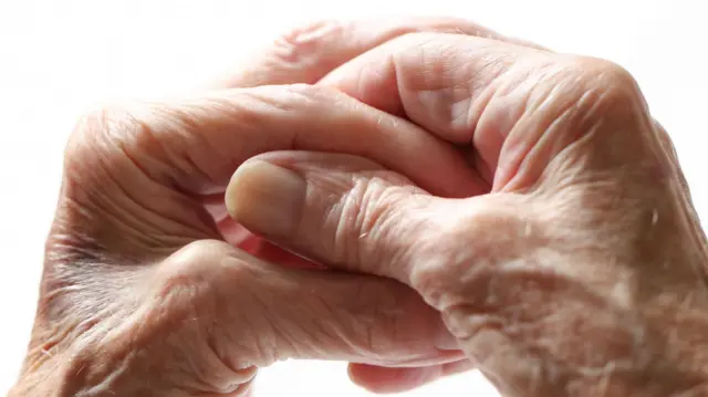 Parkinson hastası yaşlı bir kadının elleri