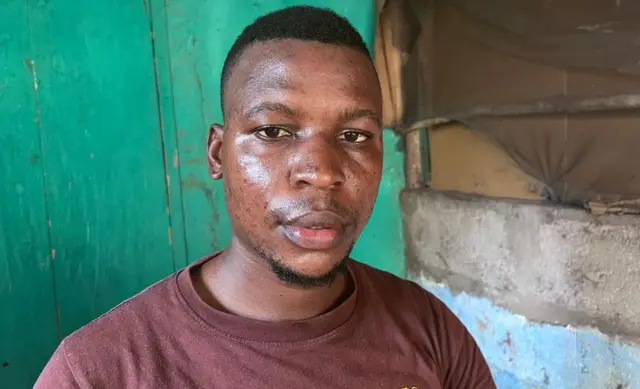 Komba Johnbull in a T-shirt