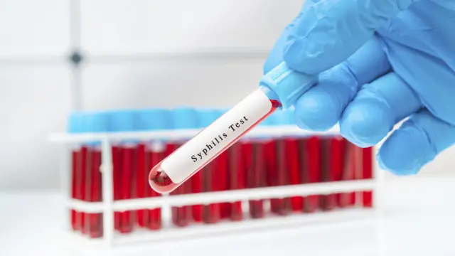 ਸਿਫਿਲਿਸ