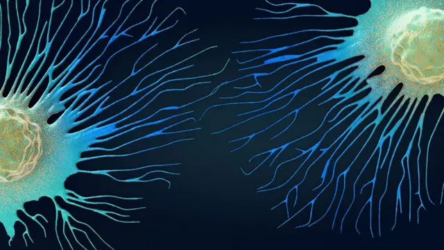 Représentation de cellules cancéreuses