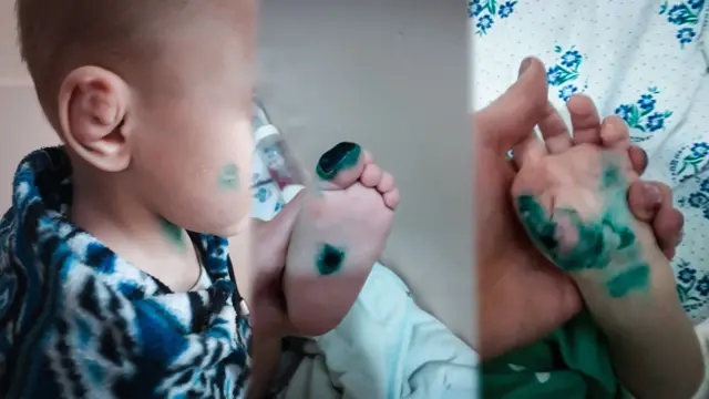 Бала азыр жарым жыл сайын медициналык кароодон өтүп турат