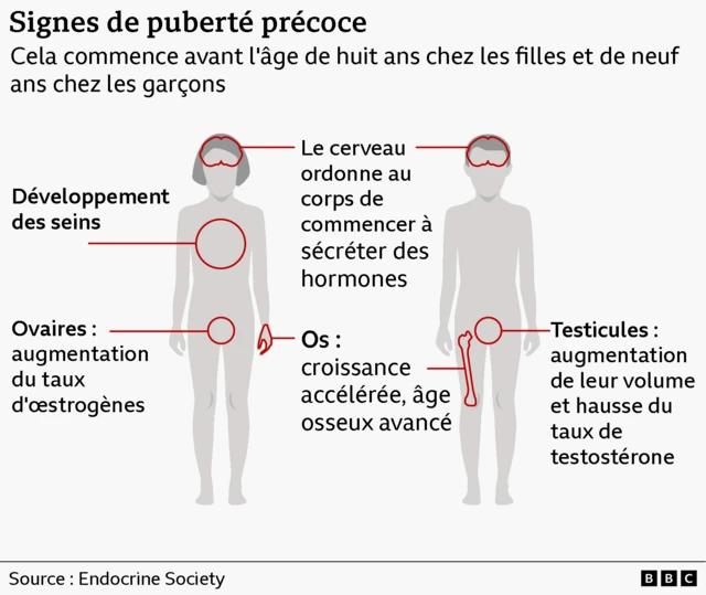 Une illustration représentant un corps masculin et un corps féminin met en évidence les signes de la puberté précoce chez les enfants.