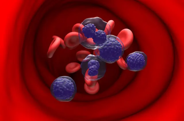 प्रातिनिधिक छायाचित्र