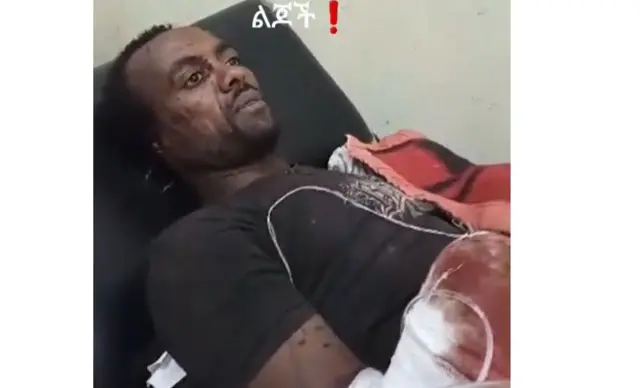 Miidhamaa naannoo Amaaraatti hidhattoonni Faannoo harkaa fi gurra isaa muran