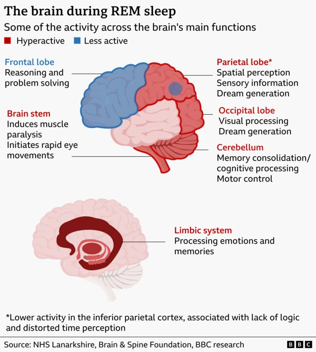 A graphic shows the brain during REM sleep, showing some of the activity across the brain's main functions. It highlights that the frontal lobe, associated with reasoning and problem solving is less active. Meanwhile the brain stem (which induces muscle paralysis and initiates rapid eye movements), the parietal lobe (associated with spatial perception, sensory information and dream generation), occipital lobe (associated with visual processing, dream generation) the cerebellum (memory consolidation/ cognitive processing, motor control) and limbic system (processing emotions and memories) and all hyperactive during sleep. 
