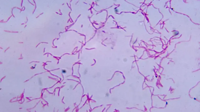 Fusobacterium nucleatum
