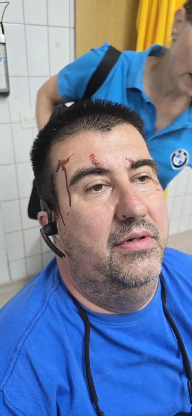 Jovica Jeremić u Urgentnom centru u Valjevu sa povredama zadobijenim u napadu