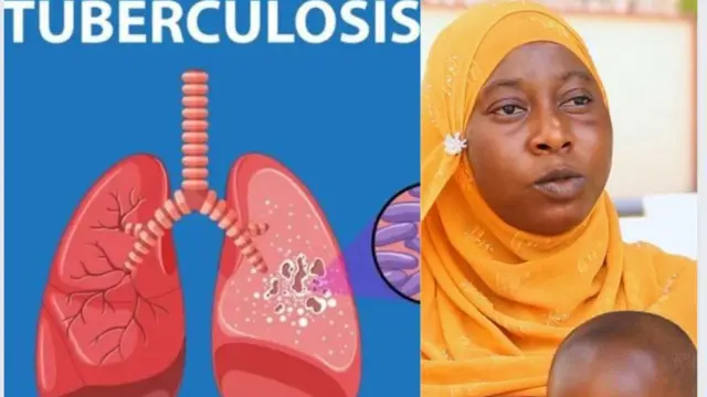 Obinrin ti ọmọ rẹ ni arun ikọ ise