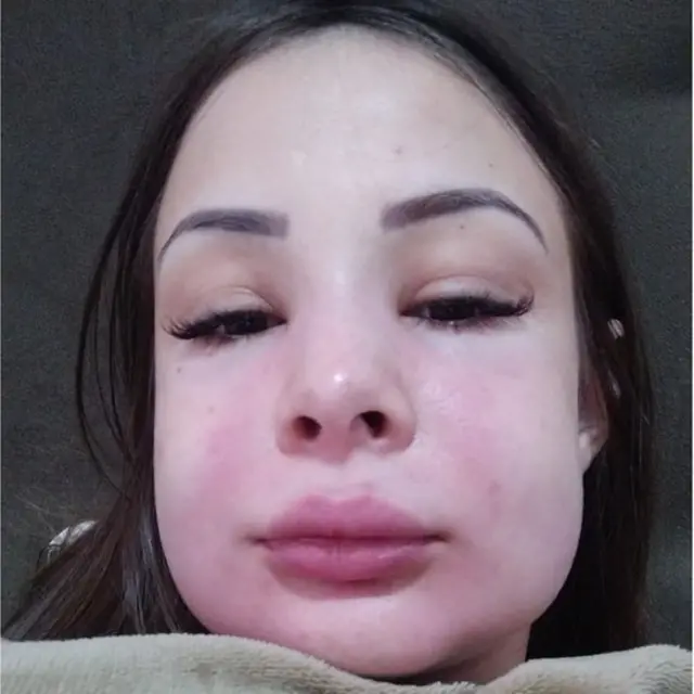 Xitaa markii ay dawada qaadatay kama degin bararka