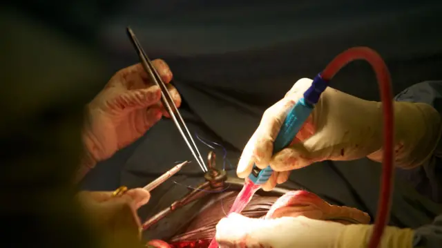 இளைஞர்களிடையே அதிகரிக்கும் சிறுநீரக செயலிழப்பு