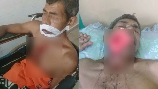 පොලිස් නිලධාරීන්ගේ පහර කෑමට ලක් වූ බව කියන පුද්ගලයා