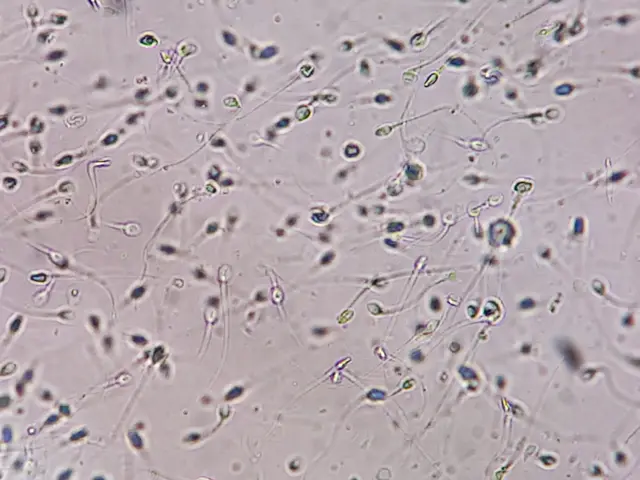 Vista microscópica de numerosos espermatozoides dispersos en una muestra biológica.