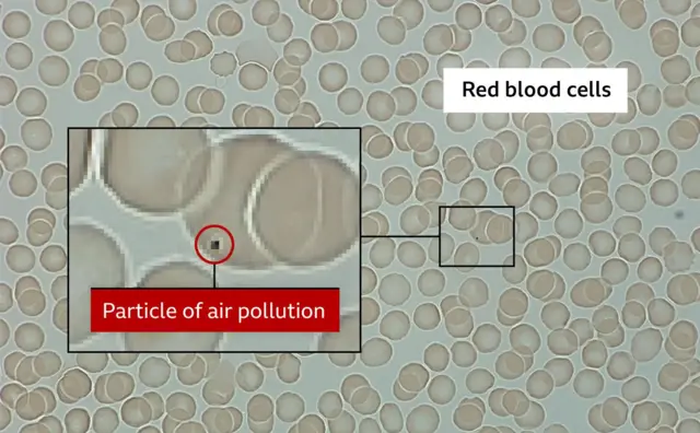 grafika krvnih zrnaca i čestica zagađenja
