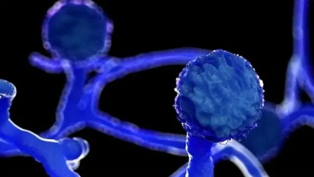 મ્યુકરમાઇકોસિસ