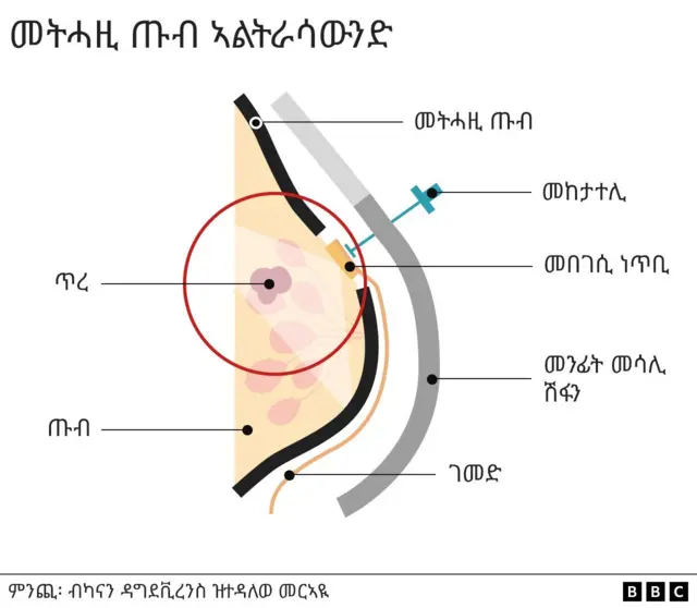 መመርመሪ ጡብ