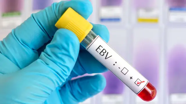 प्रतीकात्मक तस्वीर