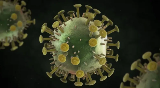 ਐਚਆਈਵੀ ਏਡਜ਼