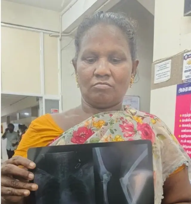 தூய்மைப் பணியாளர் மேரிக்கு கையில் காயம் ஏற்பட்டது.