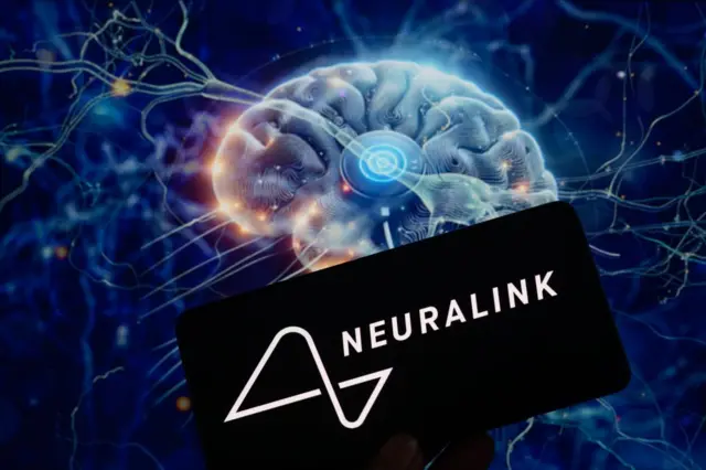 Imagem composta do logotipo Neuralink e gráficovídeo poker grátis slot machineum cérebro com implante