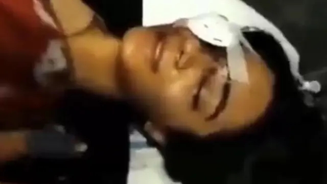 গজল রাঞ্জকেশের পোস্টের পর আহত অন্যান্যরাও সোশ্যাল মিডিয়ায় তাদের অবস্থা সম্পর্কে পোস্ট করতে শুরু করেন 