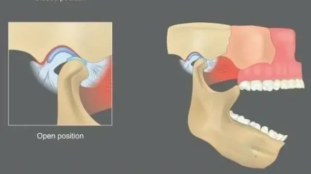 બગાસું ખાધા પછી મોં બંધ, હેલ્થ, બીબીસી ગુજરાતી, કેરળ, કન્યાકુમારી-ડિબ્રુગઢ ટ્રેન
