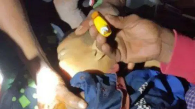 ရခိုင်ပြည်နယ်၊ ရမ်းဗြဲမြို့နယ်၊ ကျောက်နီမော်ရွာ၊ လေကြောင်းဗုံးထိမှန်ဒဏ်ရာရသူ ၅၂ ဦးထဲက ကလေးငယ် ၁ ဦး 