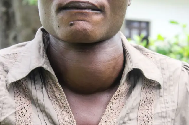 Suuraa dubartii dhibee quufa mormaatiin qabamnte