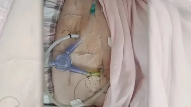 Caamsaa darbeerra kaastee hospitaalatti kan hafte Emaan achii baate ayyaana bara haaraa ijoollee ishee waliin akka kabajju abdatti