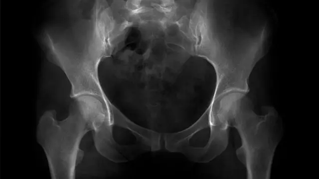 பரிணாம வளர்ச்சி, மரபணு, வால், குரங்கு