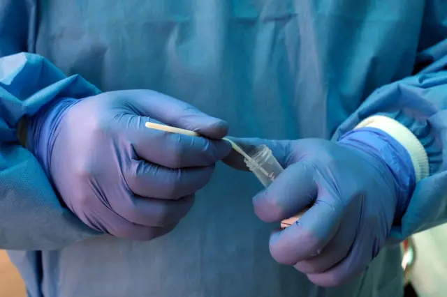 ඉන්ෆ්ලුවෙන්සා රෝගී තත්ත්වයේ වර්ධනයක් මේ දිනවල දක්නට ලැබෙන බව කායික රෝග විශේෂඥ වෛද්‍ය ආනන්ද විජේවික්‍රම පවසයි.