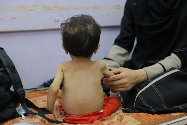 गाझा पट्टीतला दुष्काळ