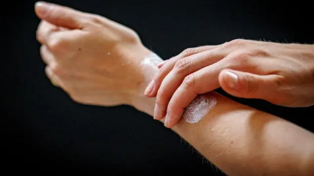 தேனீக்கள் கொட்டினால் என்ன செய்ய வேண்டும்?