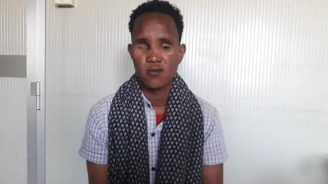 ወዲ 21 ዓመት ሃፍቶም፡ ኣብቲ ኵናት ተወቒዑ ብርሃን ዓይኑ ስኢኑ