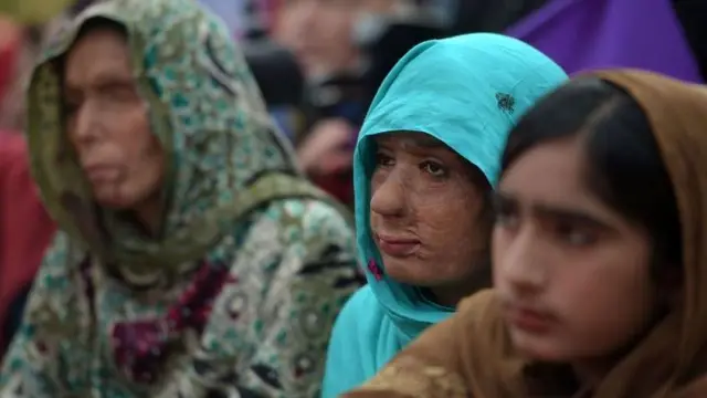 Korban serangan air keras di Pakistan bersama aktivis masyarakat sipil saat unjuk rasa memperjuangkan hak-hak perempuan pada Hari Perempuan Internasional di Islamabad pada 8 Maret 2019.